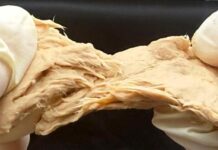 CRISPR transforma un hongo en carne sostenible y nutritiva