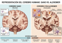 Con nanotecnología logran revertir el Alzheimer en ratones